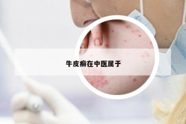牛皮癬在中醫(yī)屬于
