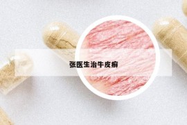 張醫(yī)生治牛皮癬