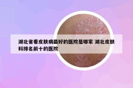 湖北省看皮膚病最好的醫(yī)院是哪家 湖北皮膚科排名前十的醫(yī)院