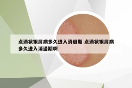 點(diǎn)滴狀銀屑病多久進(jìn)入消退期 點(diǎn)滴狀銀屑病多久進(jìn)入消退期啊