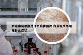 白點(diǎn)癲風(fēng)早期是什么癥狀圖片 白點(diǎn)癲風(fēng)早期是什么癥狀