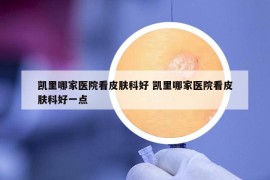 凱里哪家醫(yī)院看皮膚科好 凱里哪家醫(yī)院看皮膚科好一點(diǎn)