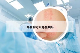 牛皮癬可以辦慢病嗎