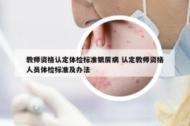 教師資格認(rèn)定體檢標(biāo)準(zhǔn)銀屑病 認(rèn)定教師資格人員體檢標(biāo)準(zhǔn)及辦法
