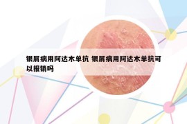 銀屑病用阿達(dá)木單抗 銀屑病用阿達(dá)木單抗可以報(bào)銷嗎