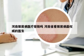河南銀屑病醫(yī)療報(bào)銷嗎 河南省看銀屑病最權(quán)威的醫(yī)生