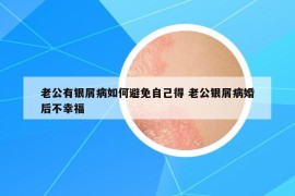 老公有銀屑病如何避免自己得 老公銀屑病婚后不幸福