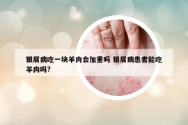 銀屑病吃一塊羊肉會加重嗎 銀屑病患者能吃羊肉嗎?