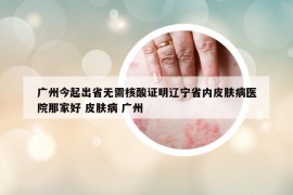 廣州今起出省無需核酸證明遼寧省內(nèi)皮膚病醫(yī)院那家好 皮膚病 廣州