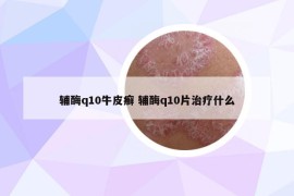 輔酶q10牛皮癬 輔酶q10片治療什么