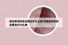 他克莫司軟膏主要治療什么病 吡美莫司軟膏主要治療什么病