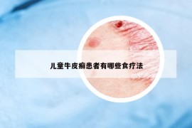 兒童牛皮癬患者有哪些食療法