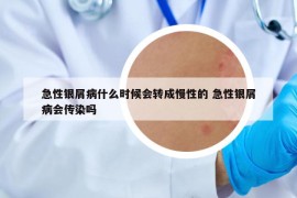 急性銀屑病什么時候會轉(zhuǎn)成慢性的 急性銀屑病會傳染嗎