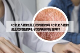 北京衛(wèi)人醫(yī)院是正規(guī)的醫(yī)院嗎 北京衛(wèi)人醫(yī)院是正規(guī)的醫(yī)院嗎,子宮內膜厚能治得好