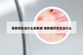 苗膚靈能治什么皮膚病 苗膚康藥膏主治什么