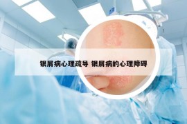 銀屑病心理疏導(dǎo) 銀屑病的心理障礙