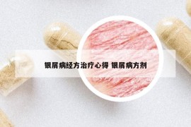銀屑病經(jīng)方治療心得 銀屑病方劑