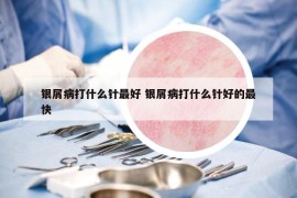 銀屑病打什么針最好 銀屑病打什么針好的最快