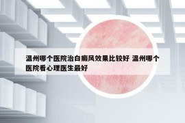 溫州哪個醫(yī)院治白癜風(fēng)效果比較好 溫州哪個醫(yī)院看心理醫(yī)生最好