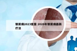銀屑病2023提案 2020年銀屑病最新療法