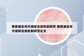 銀屑病合并代謝綜合癥機制研究 銀屑病合并代謝綜合癥機制研究論文