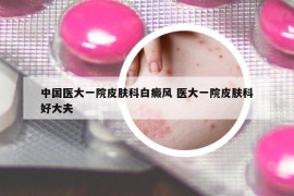 中國醫(yī)大一院皮膚科白癜風(fēng) 醫(yī)大一院皮膚科好大夫