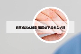 銀屑病怎么消毒 銀屑病平常怎么護理