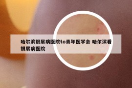 哈爾濱銀屑病醫(yī)院to青年醫(yī)學(xué)會(huì) 哈爾濱看銀屑病醫(yī)院