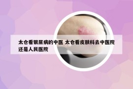 太倉(cāng)看銀屑病的中醫(yī) 太倉(cāng)看皮膚科去中醫(yī)院還是人民醫(yī)院