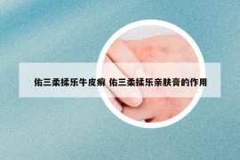 佑三柔揉樂牛皮癬 佑三柔揉樂親膚膏的作用
