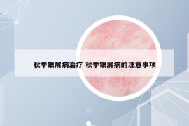 秋季銀屑病治療 秋季銀屑病的注意事項