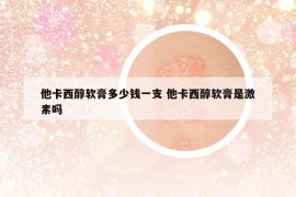 他卡西醇軟膏多少錢(qián)一支 他卡西醇軟膏是激素嗎
