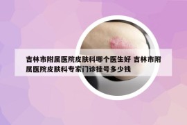 吉林市附屬醫(yī)院皮膚科哪個醫(yī)生好 吉林市附屬醫(yī)院皮膚科專家門診掛號多少錢