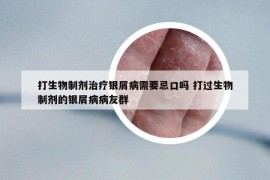打生物制劑治療銀屑病需要忌口嗎 打過(guò)生物制劑的銀屑病病友群