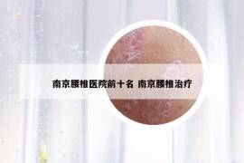 南京腰椎醫(yī)院前十名 南京腰椎治療