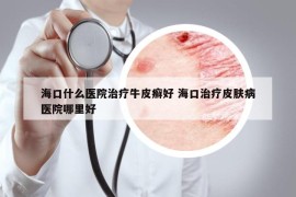 海口什么醫(yī)院治療牛皮癬好 ?？谥委熎つw病醫(yī)院哪里好