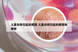 兒童白斑引起的原因 兒童白斑引起的原因有哪些
