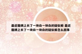 最近胳膊上長(zhǎng)了一塊白一塊白的疑似癬 最近胳膊上長(zhǎng)了一塊白一塊白的疑似癬怎么回事