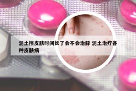 泥土擦皮膚時(shí)間長(zhǎng)了會(huì)不會(huì)治蘚 泥土治療各種皮膚病