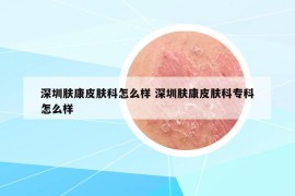深圳膚康皮膚科怎么樣 深圳膚康皮膚科?？圃趺礃? /></a>		
		</figure>

		<header class=