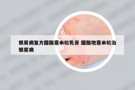 銀屑病復(fù)方醋酸塞米松乳膏 醋酸地塞米松治銀屑病