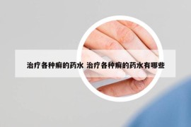治療各種癬的藥水 治療各種癬的藥水有哪些