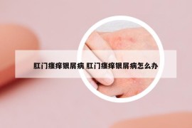 肛門瘙癢銀屑病 肛門瘙癢銀屑病怎么辦