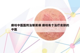 廊坊中醫(yī)醫(yī)院治銀屑病 廊坊有個治療皮膚的中醫(yī)