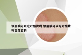 銀屑病可以吃葉酸片嗎 銀屑病可以吃葉酸片嗎百度百科