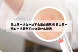 臉上黑一塊白一塊不會(huì)是白癜風(fēng)吧 臉上黑一塊白一塊膚色不均勻是什么原因