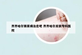 齊齊哈爾銀屑病治愈吧 齊齊哈爾皮膚?？漆t(yī)院