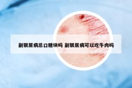 副銀屑病忌口糖塊嗎 副銀屑病可以吃牛肉嗎