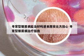 尋常型銀屑病能治好嗎速來(lái)西安北方放心 尋常型銀屑病治療指南