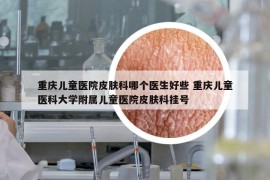 重慶兒童醫(yī)院皮膚科哪個(gè)醫(yī)生好些 重慶兒童醫(yī)科大學(xué)附屬兒童醫(yī)院皮膚科掛號
